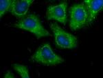 IMPDH2 Antibody in Immunocytochemistry (ICC/IF)