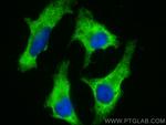 EIF2AK1 Antibody in Immunocytochemistry (ICC/IF)