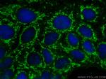 SLC6A12 Antibody in Immunocytochemistry (ICC/IF)