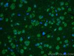 TNC/Tenascin-C Antibody in Immunohistochemistry (PFA fixed) (IHC (PFA))