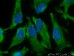 NARS Antibody in Immunocytochemistry (ICC/IF)