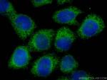 EIF3A Antibody in Immunocytochemistry (ICC/IF)