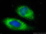 ATG4B Antibody in Immunocytochemistry (ICC/IF)