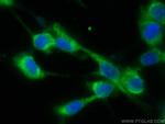 VAMP2 Antibody in Immunocytochemistry (ICC/IF)