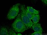 LMCD1 Antibody in Immunocytochemistry (ICC/IF)