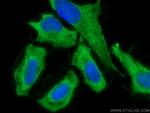 CIP2A Antibody in Immunocytochemistry (ICC/IF)