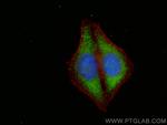 HABP2 Antibody in Immunocytochemistry (ICC/IF)