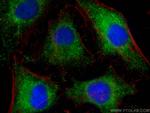 HAX1 Antibody in Immunocytochemistry (ICC/IF)