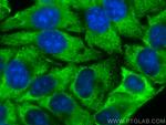 EIF5A2 Antibody in Immunocytochemistry (ICC/IF)