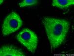 SHMT1 Antibody in Immunocytochemistry (ICC/IF)