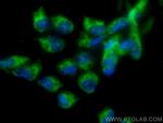 PIK3CD Antibody in Immunocytochemistry (ICC/IF)