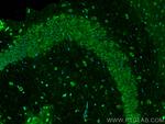 MFSD2 Antibody in Immunohistochemistry (PFA fixed) (IHC (PFA))