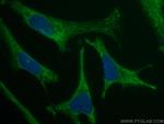 MON1B Antibody in Immunocytochemistry (ICC/IF)