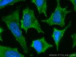 RAB9B Antibody in Immunocytochemistry (ICC/IF)