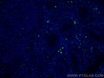 CR1 Antibody in Immunohistochemistry (PFA fixed) (IHC (PFA))