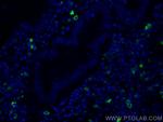 CR1 Antibody in Immunohistochemistry (PFA fixed) (IHC (PFA))