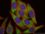 ZFP36L1 Antibody in Immunocytochemistry (ICC/IF)