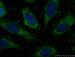 SMS Antibody in Immunocytochemistry (ICC/IF)