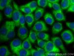 TPD52L2 Antibody in Immunocytochemistry (ICC/IF)