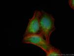 PRAME Antibody in Immunocytochemistry (ICC/IF)