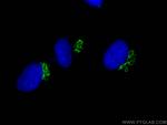 p115, USO1 Antibody in Immunocytochemistry (ICC/IF)