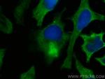 CEP89, CCDC123 Antibody in Immunocytochemistry (ICC/IF)