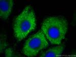 DCT Antibody in Immunocytochemistry (ICC/IF)
