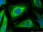 BNIP3L Antibody in Immunocytochemistry (ICC/IF)