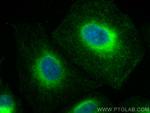 REEP5 Antibody in Immunocytochemistry (ICC/IF)