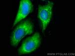 MAN1B1 Antibody in Immunocytochemistry (ICC/IF)