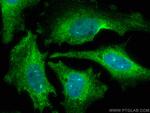PPP1CC Antibody in Immunocytochemistry (ICC/IF)