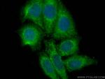 PSMA8 Antibody in Immunocytochemistry (ICC/IF)
