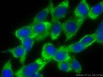 LPIN1 Antibody in Immunocytochemistry (ICC/IF)