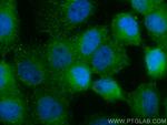 RBP5 Antibody in Immunocytochemistry (ICC/IF)