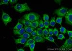 ATP5J2 Antibody in Immunocytochemistry (ICC/IF)