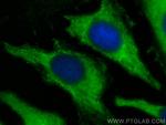 PFKP Antibody in Immunocytochemistry (ICC/IF)
