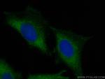 PLA2G4A Antibody in Immunocytochemistry (ICC/IF)