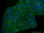 TACSTD2/TROP2 Antibody in Immunocytochemistry (ICC/IF)