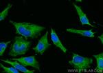 MYL6 Antibody in Immunocytochemistry (ICC/IF)
