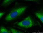 HBS1L Antibody in Immunocytochemistry (ICC/IF)