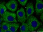 AIDA Antibody in Immunocytochemistry (ICC/IF)