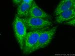HIBCH Antibody in Immunocytochemistry (ICC/IF)