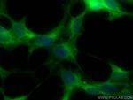 CACYBP Antibody in Immunocytochemistry (ICC/IF)