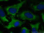 PPA1 Antibody in Immunocytochemistry (ICC/IF)