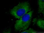 PPA1 Antibody in Immunocytochemistry (ICC/IF)