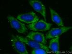 PSMB2 Antibody in Immunocytochemistry (ICC/IF)