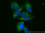 PSMB2 Antibody in Immunocytochemistry (ICC/IF)