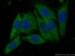 VPS25 Antibody in Immunocytochemistry (ICC/IF)
