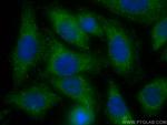 ARF4 Antibody in Immunocytochemistry (ICC/IF)