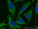 LETM1 Antibody in Immunocytochemistry (ICC/IF)